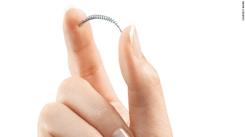 ESSURE