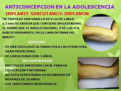 ANTICONCEPCION EN LA ADOLESCENCCIA-44.pptx