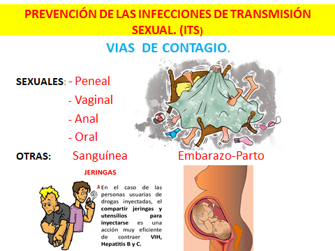 PREVENCION ITS-3