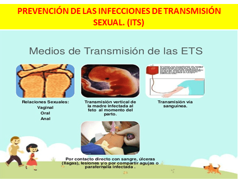 PREVENCION ITS-4