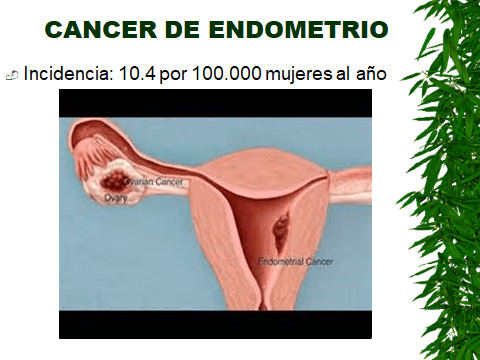 CANCER DE ENDOMETRIO-1