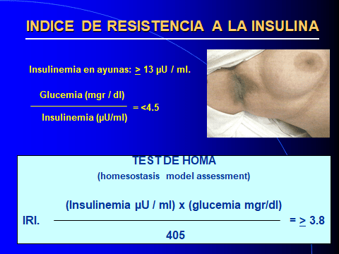 OVARIOS POLIQUISTICOS. INDICE R. INSULINA.-