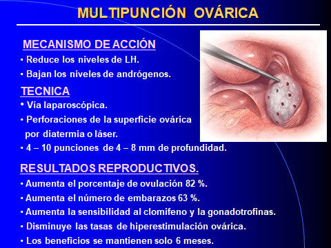 OVARIOS POLIQUISTICOS. TRATAMIENTO--17