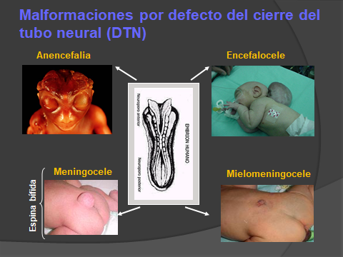 FOLATOS Y EMBARAZO.2